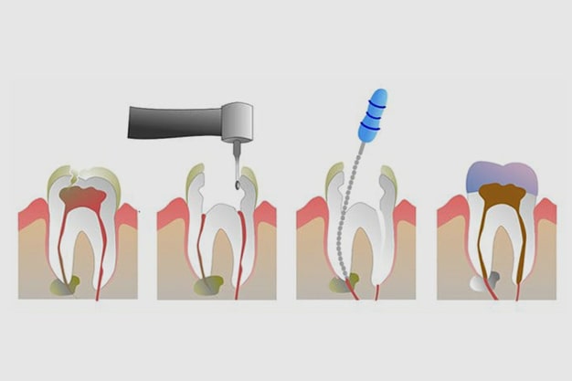 Deepam Dental Clinic